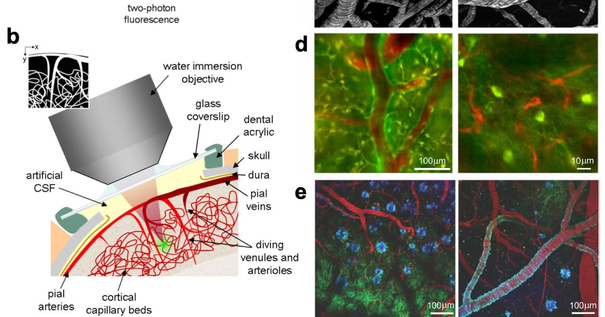 Stanford Scientists Grow Human Brain Tissue Inside Mice in Landmark Psychiatric Research Step