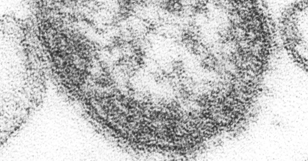 Pennsylvania Requests CDC Epi-Aid as Measles Cases Reach 731 and Deaths Hit Four