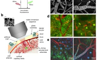 Stanford Scientists Grow Human Brain Tissue Inside Mice in Landmark Psychiatric Research Step