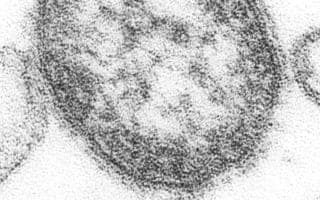 Pennsylvania Requests CDC Epi-Aid as Measles Cases Reach 731 and Deaths Hit Four