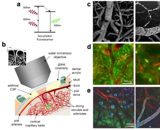 Stanford Scientists Grow Human Brain Tissue Inside Mice in Landmark Psychiatric Research Step
