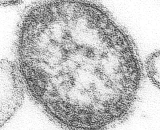 Pennsylvania Requests CDC Epi-Aid as Measles Cases Reach 731 and Deaths Hit Four